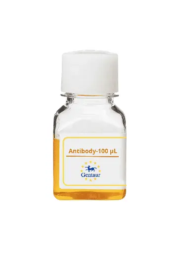 [CSB-1037] ALKBH4 Antibody  Biotin conjugated   