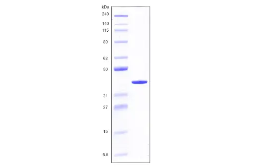 [MC03-100] Recombinant Human Galectin 8, variant 1, His Tag (317 a.a.) -100 ug